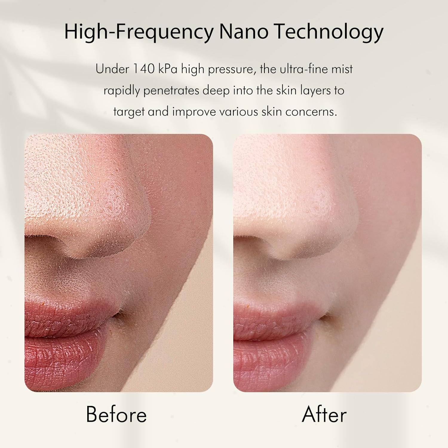 Vaporizador Facial Nano Iônico - Face Steamer avaliação e preço